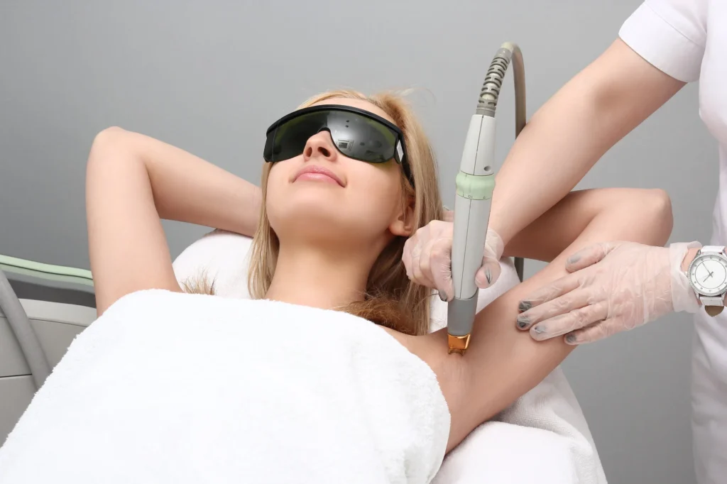 Laser Hair Removal in Redmond, WA: Elite iQ® Technology for Lasting Results