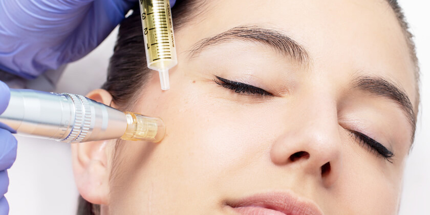 Revive Face Mesotherapy