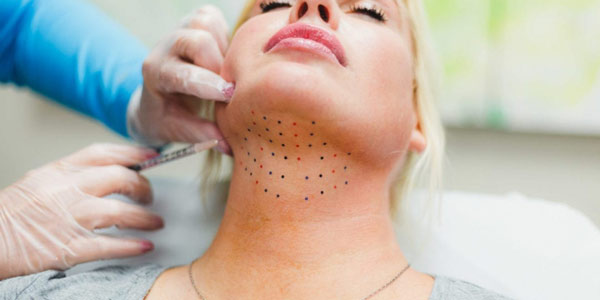 kybella