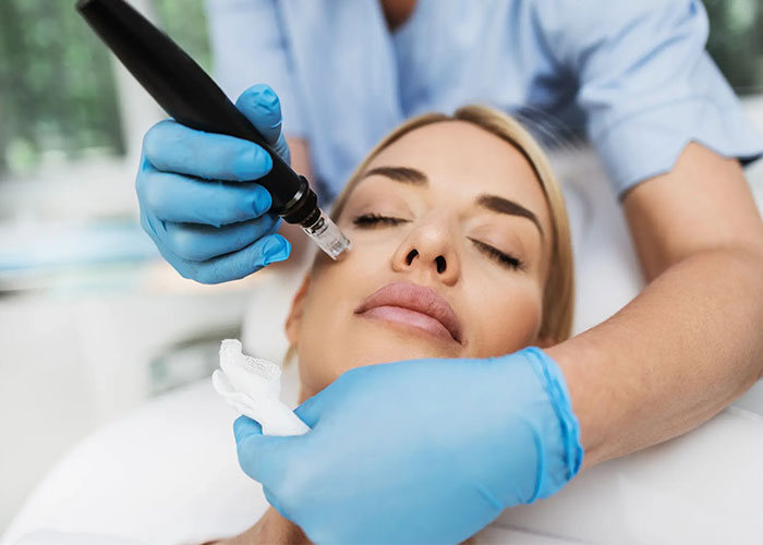 Microneedling